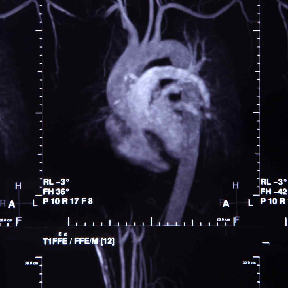 inner_image_05 https://www.asrasmedical.com/wp-content/uploads/2021/08/inner_image_05.jpg